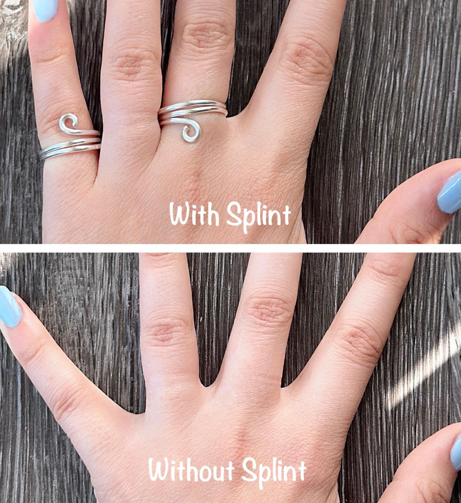 The Hazel three finger buddy ring splint, handmade by Evergreen Ring Splints