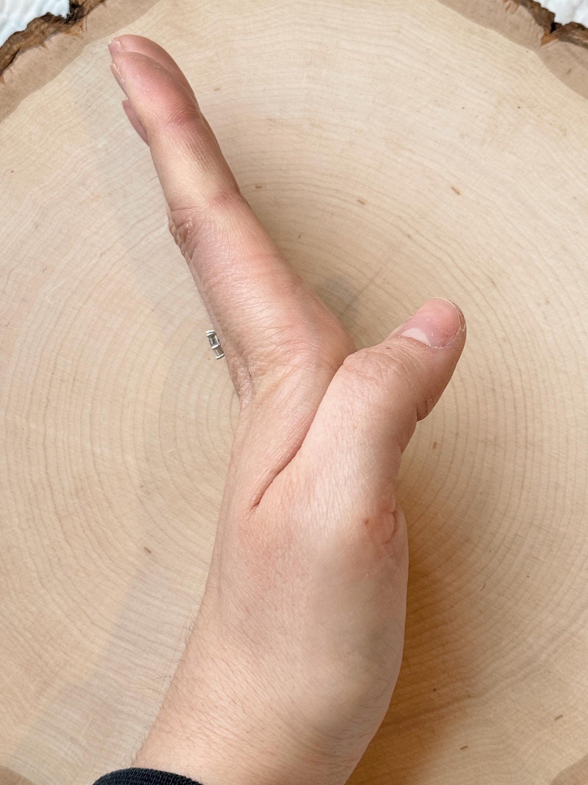 The Spruce MCP ring splint, handmade by Evergreen Ring Splints