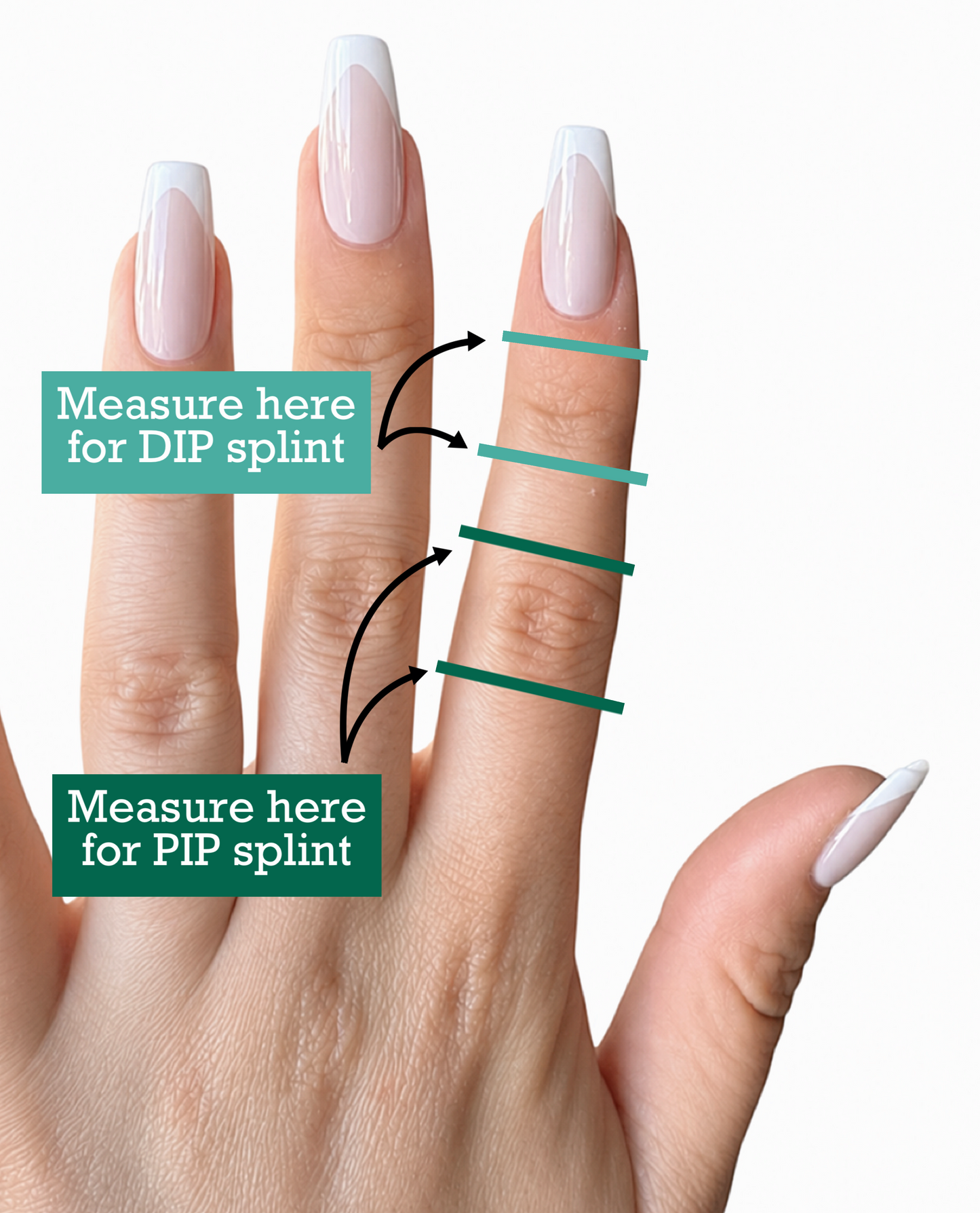 The Dahlia | Extra Support Mallet Splint